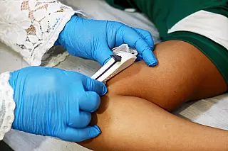 SUS oferecerá contraceptivo de alta eficácia que dura até três anos